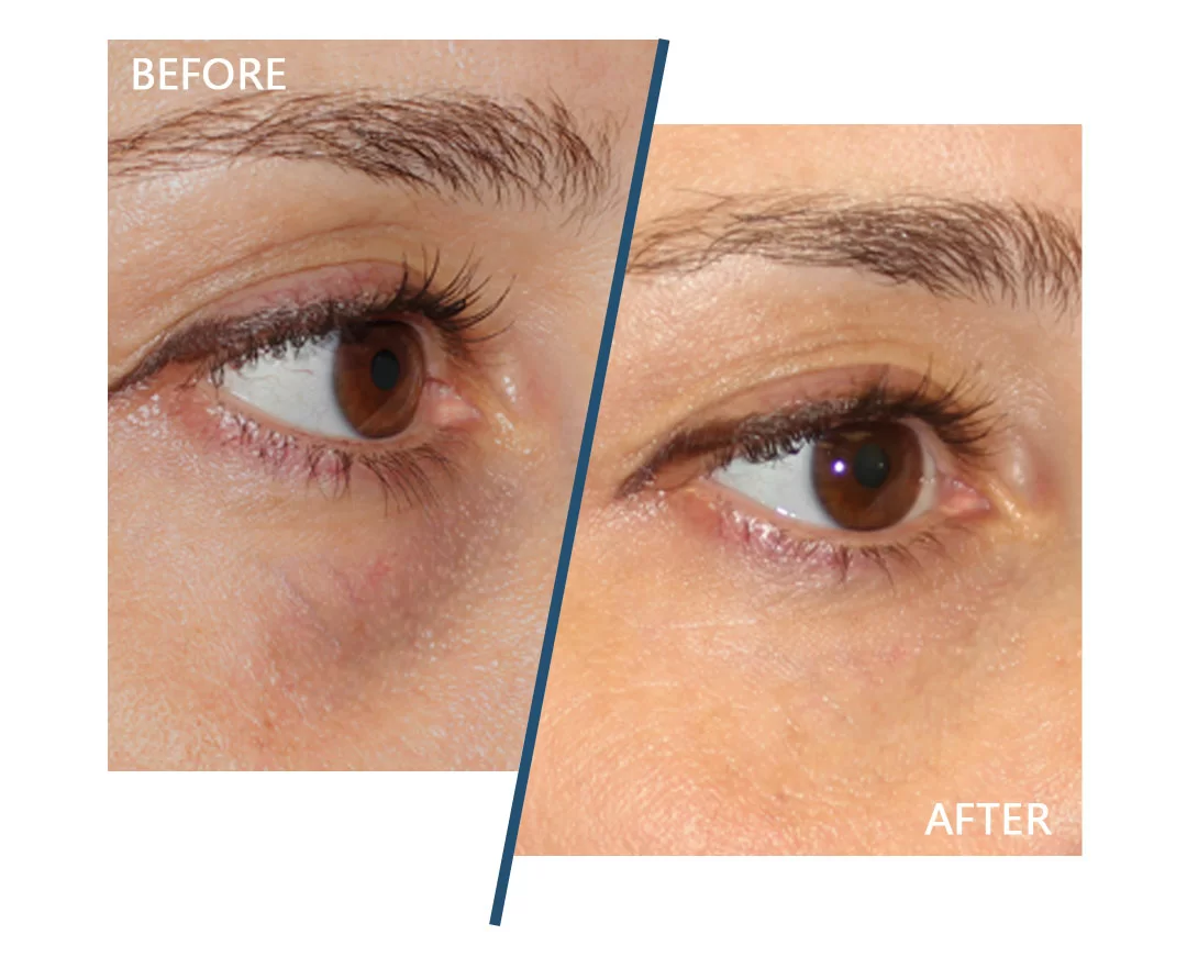 Authentic EYE AREA Products - Nexus-Derma