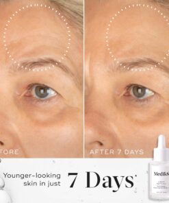 Before and After Liquid Peptides